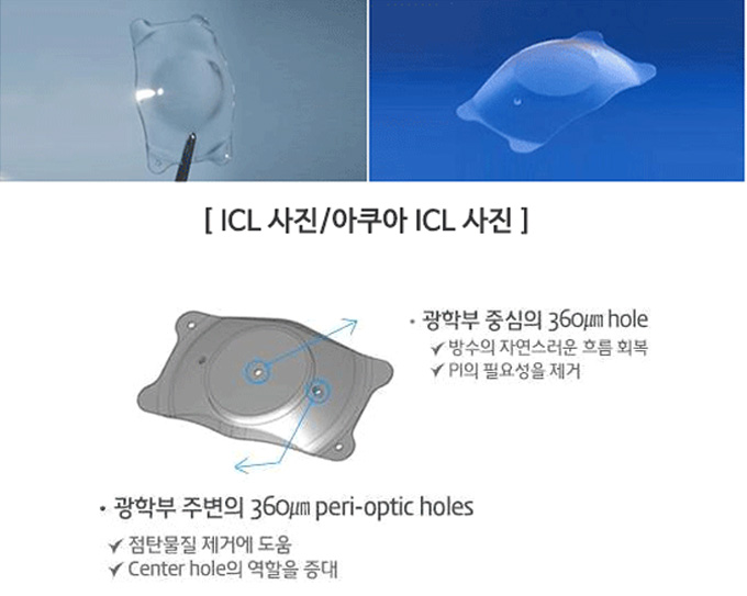 ICL/아쿠아 ICL